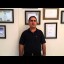Mehmet Reyhan - Beyin Tümörü Hastası - Prof. Dr. Orhan Şen